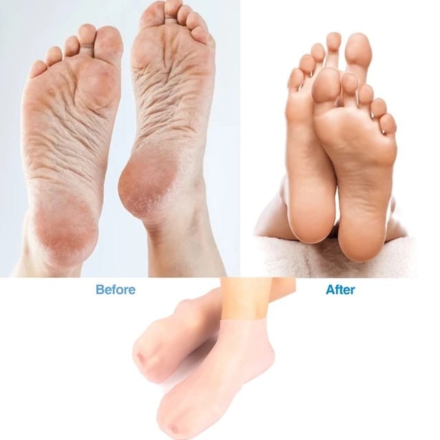 1 Pair Silicone Moisturizing Gel Foot Care Socks